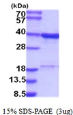 Human RPRD1B protein, His tag. GTX68672-pro