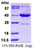 Human Serine racemase protein, His tag. GTX68682-pro
