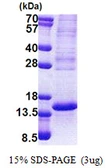 Human p53 AIP1 protein, His tag. GTX68685-pro