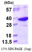 Human LHPP protein, His tag. GTX68686-pro