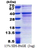 Human WIG1 protein, His tag. GTX68696-pro