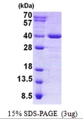 Human AIDA protein, His tag. GTX68704-pro