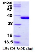 Human CHMP6 protein, His tag. GTX68735-pro