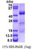 Human OBFC1 protein, His tag. GTX68750-pro