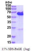 Human CDK5RAP3 protein, His tag. GTX68758-pro