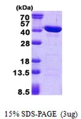 Human CAB39L protein, His tag. GTX68772-pro