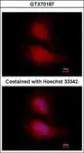 Anti-FOXO1 antibody [14E4] used in Immunocytochemistry/ Immunofluorescence (ICC/IF). GTX70187