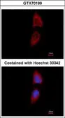 Anti-PNPase antibody [3H5] used in Immunocytochemistry/ Immunofluorescence (ICC/IF). GTX70199