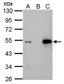 Anti-p53 antibody [Pab1801] used in Immunoprecipitation (IP). GTX70216