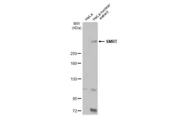 Anti-SMRT antibody [1542] used in Western Blot (WB). GTX70248