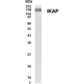 Anti-IKAP antibody used in Western Blot (WB). GTX70365