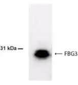 Anti-FBXO44 antibody used in Western Blot (WB). GTX70479