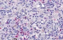 Anti-GPCR HM74 antibody used in IHC (Paraffin sections) (IHC-P). GTX70581