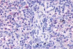 Anti-FPR3 antibody used in IHC (Paraffin sections) (IHC-P). GTX70659