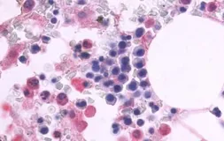 Anti-CD97 antibody used in IHC (Paraffin sections) (IHC-P). GTX70829