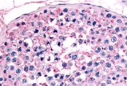Anti-GCNF antibody used in IHC (Paraffin sections) (IHC-P). GTX70915
