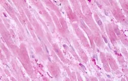 Anti-PTPRA antibody used in IHC (Paraffin sections) (IHC-P). GTX70943