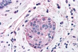 Anti-XPR1 antibody used in IHC (Paraffin sections) (IHC-P). GTX71325