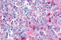 Anti-Frizzled 8 antibody used in IHC (Paraffin sections) (IHC-P). GTX71543