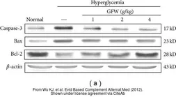 Anti-Caspase 3 antibody used in Western Blot (WB). GTX73090