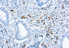 Rabbit Anti-Human kappa light chain antibody. GTX73364