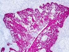 Anti-HMW Cytokeratin antibody [34βE12] used in IHC (Paraffin sections) (IHC-P). GTX73669
