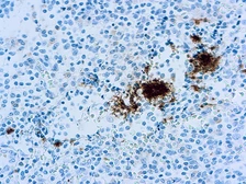 Anti-Integrin beta 3 antibody [Y2/51] used in IHC (Paraffin sections) (IHC-P). GTX73704