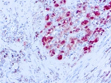 Anti-S100 antibody [SH-B1] used in IHC (Paraffin sections) (IHC-P). GTX73714