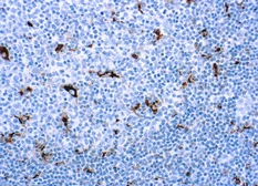 Anti-CD68 antibody [PG-M1] used in IHC (Paraffin sections) (IHC-P). GTX73723