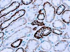 Anti-pan Cadherin antibody [CH-19] used in IHC (Paraffin sections) (IHC-P). GTX73744
