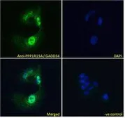 Anti-GADD34 antibody, C-term used in Immunocytochemistry/ Immunofluorescence (ICC/IF). GTX74479