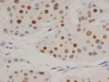 Anti-Progesterone Receptor antibody [1A6] used in IHC (Paraffin sections) (IHC-P). GTX75363