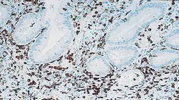 Anti-CD16 antibody [2H7] used in IHC (Paraffin sections) (IHC-P). GTX75391
