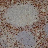 Anti-CD8 antibody [4B11] used in IHC (Paraffin sections) (IHC-P). GTX75394