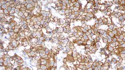 Anti-Her2 / ErbB2 antibody [CB11] used in IHC (Paraffin sections) (IHC-P). GTX75559