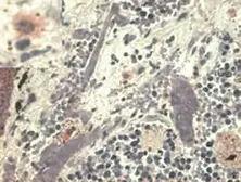 Anti-HLA-G antibody [MEM-G/1] used in  (). GTX75708