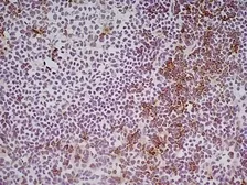 Anti-CD8 alpha antibody [KT15] used in IHC (Frozen sections) (IHC-Fr). GTX76350