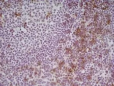 Anti-CD8 alpha antibody [KT15] used in IHC (Frozen sections) (IHC-Fr). GTX76351