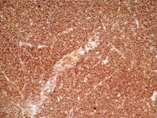 Anti-CD36 antibody [SMØ] (Azide free) used in IHC (Frozen sections) (IHC-Fr). GTX76436