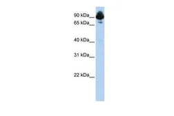 Anti-RGS3 antibody, C-term used in Western Blot (WB). GTX77726