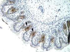 Anti-TEL antibody, C-term used in IHC (Paraffin sections) (IHC-P). GTX77770