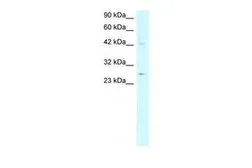 Anti-Adiponectin antibody, N-term used in Western Blot (WB). GTX77828