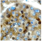 Anti-PIT1 antibody, C-term used in IHC (Paraffin sections) (IHC-P). GTX77853