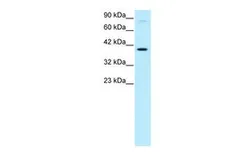 Anti-KIN antibody, Internal used in Western Blot (WB). GTX77858