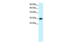 Anti-RAX antibody, N-term used in Western Blot (WB). GTX77859