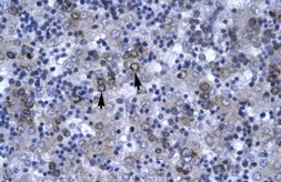 Anti-DBP antibody, N-term used in IHC (Paraffin sections) (IHC-P). GTX77870