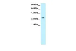 Anti-PAR4 antibody, Internal used in Western Blot (WB). GTX77887
