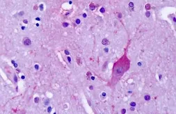 Anti-mGluR4 antibody used in IHC (Paraffin sections) (IHC-P). GTX78079