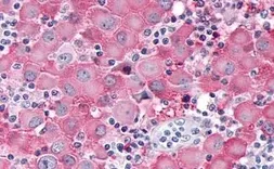 Anti-ADAMTS4 antibody used in IHC (Paraffin sections) (IHC-P). GTX78143