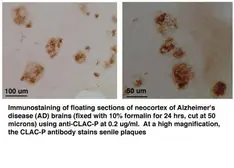 Anti-CLACP antibody used in Immunohistochemistry (IHC). GTX78175